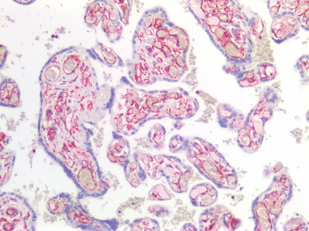 Figure 4. Immunostaining of human paraffin embedded tissue section of placenta with MUB1903P (diluted 1:100), showing the specific pattern of vimentin in the mesenchymal cell types, such as fibroblasts in the connective tissue, and endothelial cells in blood vessels. As expected, no reactivity is seen in the epithelial cell compartment